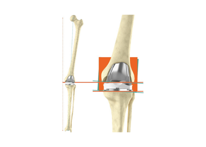 Kinematic Alignment