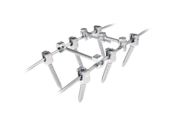 Système de fixation thoraco-lombaire postérieur Silver
